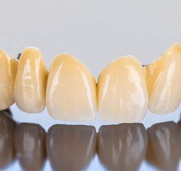 Damaged Teeth Suitably Covered by Dental Crowns