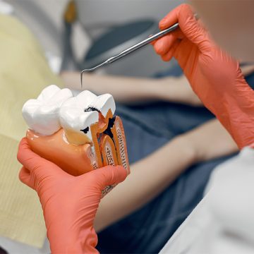 What Happens During a Dental Filling Appointment? Step-by-Step